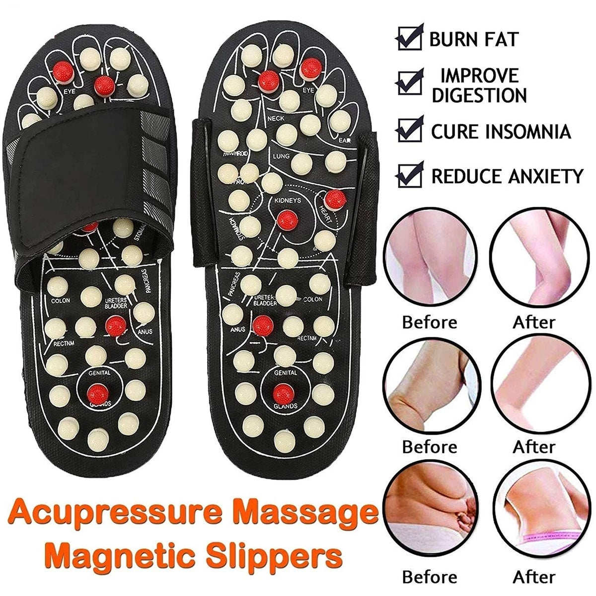 Chaussons d'acupression et de magntothrapie 50 % DE RDUCTION