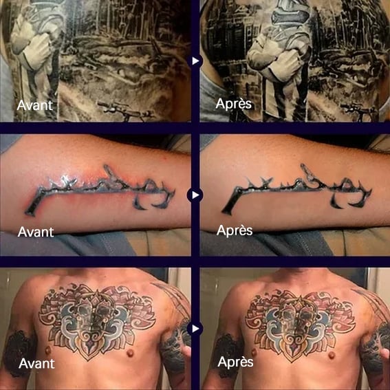 Aufhellender Tattoo-Pflegebalsam
